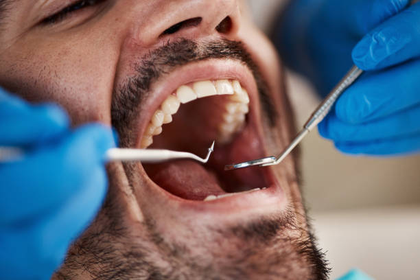 Best Emergency Dentist for Knocked-Out Tooth in Hampton, IL