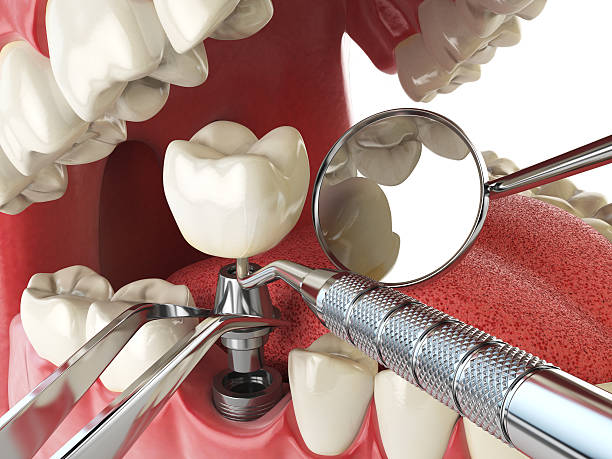 Best Emergency Dental Services for Seniors in Hampton, IL